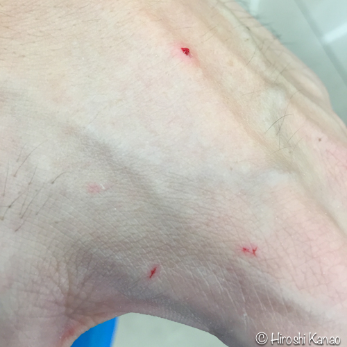 タイの野良猫に噛まれた傷